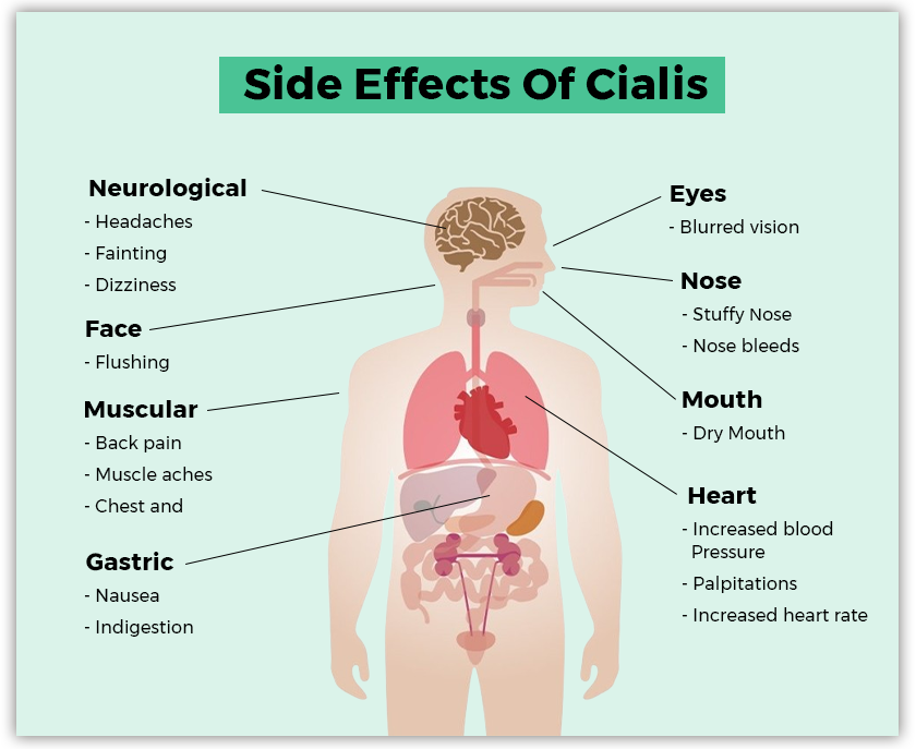 Side effects of Cialis