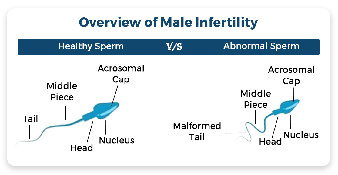 Overview of male infertility, penis, blood flow