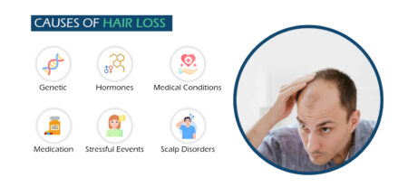 Are There Common Triggers For Erectile Issues And Hair Loss?