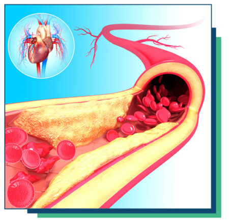 The Effects Of High Blood Pressure On Erectile Dysfunction