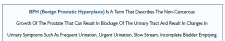 Benign Prostatic Hyperplasia