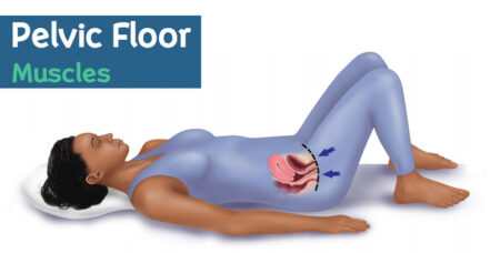 How To Treat Pelvic Floor Dysfunction